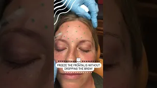 Freeze the Frontalis without Dropping the Brow