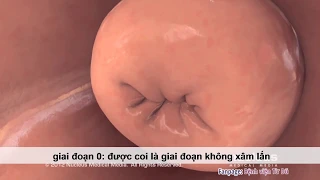 Các giai đoạn Ung thư cổ tử cung  - Bệnh viện Từ Dũ