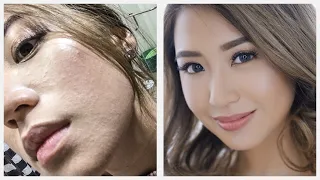 Sudden Sandy Skin Texture- Remedy | Kryz Uy