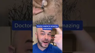 Doctor reacts to UNREAL extraction! #hair #dermreacts #doctorreacts