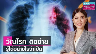 วัณโรค โรคติดต่อที่ต้องทำความเข้าใจ รู้เร็ว รักษาหาย ไม่แพร่กระจาย : TNN Health