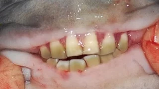 Пираньи мутанты с человеческими зубами