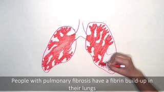 Systemic Enzyme Therapy and Pulmonary Fibrosis - Presented by Pulmonary Fibrosis NOW!