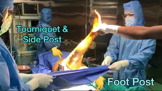 TKR - Live Knee draping Technique | Best Method of Draping For Knee Surgery..🔥🔥