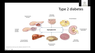 Standards of Medical Care in Diabetes 2020