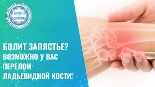 🤜  Болит запястье? Возможно у вас перелом ладьевидной кости!