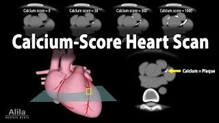Calcium Score Heart Scan, Animation