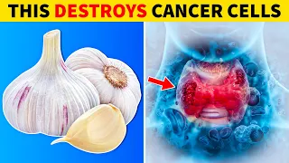 Top 7 Foods That PREVENT And Kill Cancer!