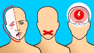 6 Señales que advierten sobre la proximidad de un derrame cerebral