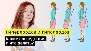 Гиперлордоз и гиполордоз. Какие последствия? Что делать?