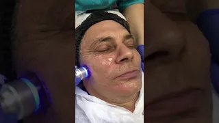 Многофункциональный аппарат ProFacial 6 в 1 (часть2)