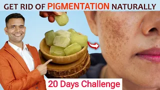 20 Days Challenge | Get Rid Of Pigmentation, Melasma Dark Spot Naturally