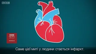 Що таке інфаркт і як його уникнути