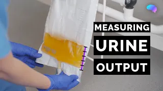 Measuring Urine Output - OSCE Guide | Catheter