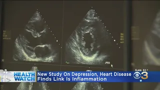 Researchers Find Link Between Depression And Heart Disease