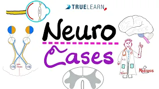 Neuro Cases (with answers)- TrueLearn Qbank - Vignettes