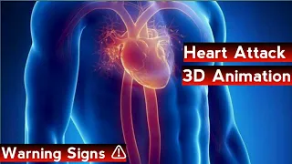 Recognizing a heart attack || 3D Animation  #serihealthtv #cardiology #heartattack #warningsigns