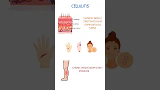 CELLULITIS PATHOPHYSIOLOGY