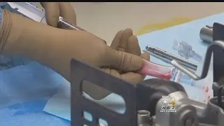 I-Team: New Warning About Stem Cell Therapies