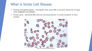 iPiece Sickle Cell Disease Part 1