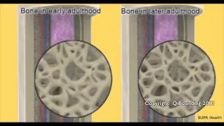 QiBounding - Why Rebounding supports Bone Density