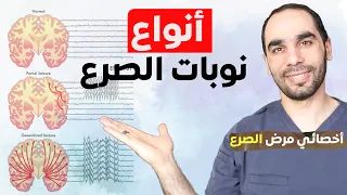 كيف اعرف ان عندي مرض الصرع. كل أنواع التشنجات التي لم تسمع بها من قبل