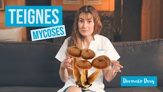 Les teignes ! Parlons mycoses, c'est la saison des champignons ! @DermatoDrey