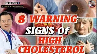 8 Warning Signs of High Cholesterol - Tips by Doc Willie Ong