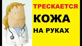 Почему трескается кожа на руках?