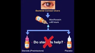 SCUT - Steroids for Corneal Ulcers Trial