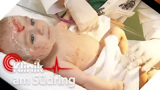 Schock nach der Geburt: Baby atmet nicht | Klinik am Südring | SAT.1 TV