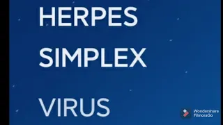 Herpes simplex virus