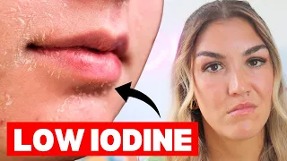 8 Signs of Iodine Deficiency You Might Not Expect