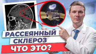 Что такое рассеянный склероз?