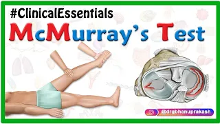 McMurray’s Test for Meniscal Tear : Clinical essentials