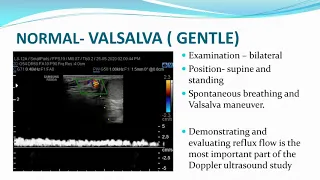 varicocele doppler technique. Dr Prashant Onkar