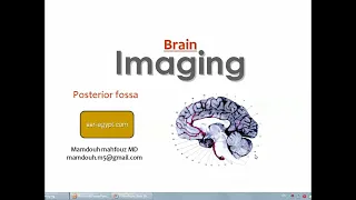 Imaging of Posterior fossa lesions (DRE) Prof. Mamdouh Mahfouz