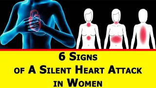 6 Signs of A Silent Heart Attack in Women