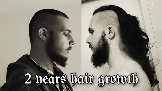 2 years hair growth time lapse - side (before and after)