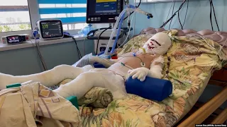 'Burns Cover 40 Percent Of His Body': Young Boy Survives Russian Attack That Killed His Mother GRAB