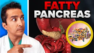 Fat Accumulation In The Pancreas Can Be Deadly! Here is Why..