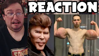 Gor's "Bad Plastic Surgery by Degenerocity" REACTION