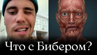 Что случилось с Джастином Бибером?