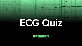 ECG Quiz: Low Difficulty