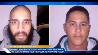 Jovem tatuado na testa - Clínica Grand House no "Hoje em Dia"