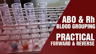 Blood Grouping Test | Principle and procedure | Cell Grouping | Serum Grouping