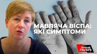 Мавпяча віспа в Україні. Що робити при перших симптомах захворювання?