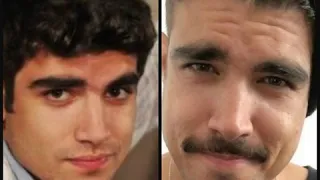 Antes e Depois dos famosos