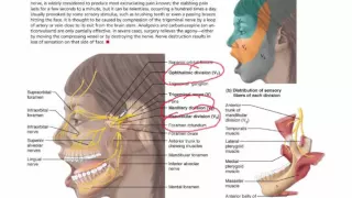 Chapter 13 Lecture C - Cranial Nerves