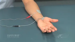 Electrode Placement for Thumb Abduction